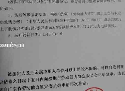 广东省伤情鉴定电话，了解与使用指南